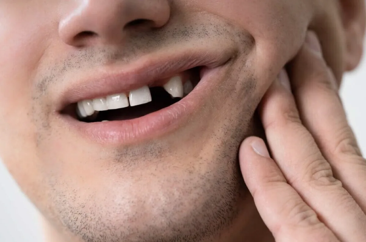 Man with a knocked-out front tooth holding his cheek