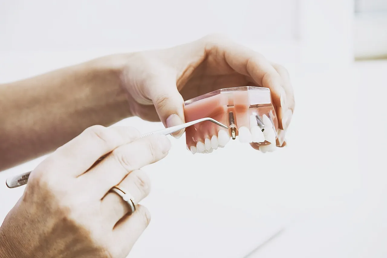 Dentist showing a dental implant on a model of the jaw